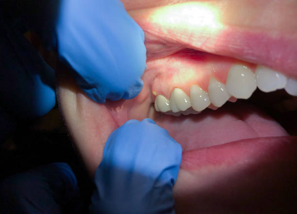 Best Emergency Cosmetic Dentistry in Millersburg, OH
