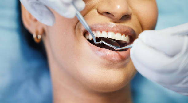Best Emergency Dentist for Lost Fillings or Crowns in Millersburg, OH