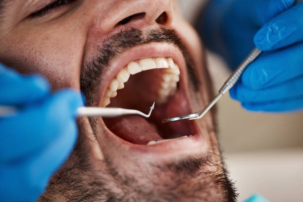 Best Broken or Cracked Tooth Emergency Dentist in Millersburg, OH